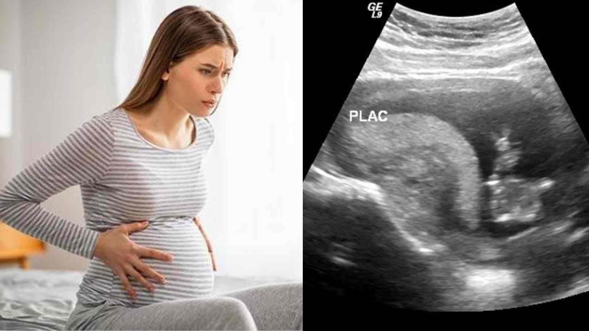Braxton Hicks Contractions: Care Instructions, How to Prepare for Labour