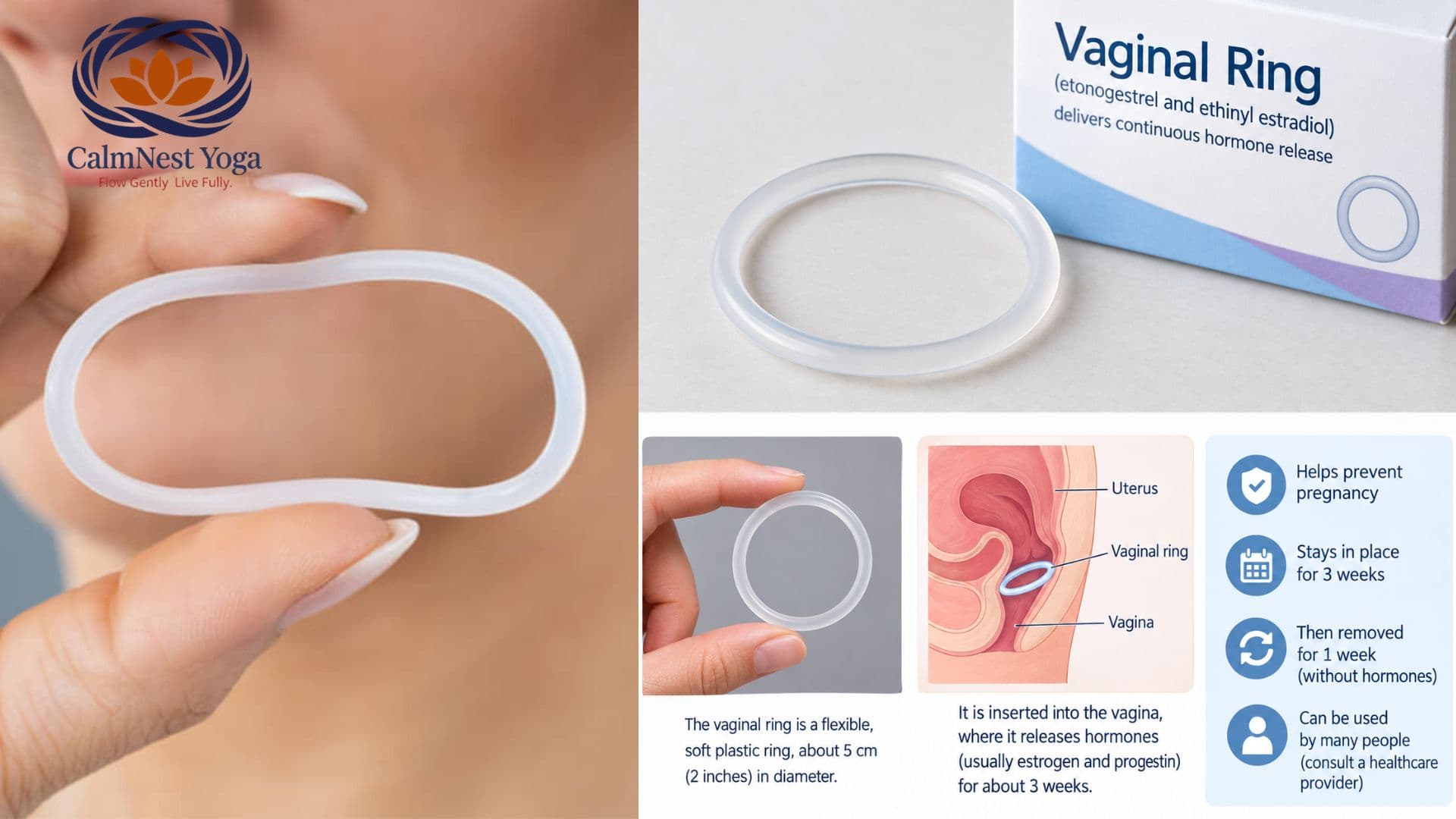 Vaginal Ring: What It Is, How It Works, Effectiveness and Usage Duration